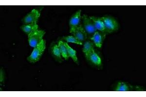 Immunofluorescent analysis of Hela cells using ABIN7148332 at dilution of 1:100 and Alexa Fluor 488-congugated AffiniPure Goat Anti-Rabbit IgG(H+L) (C1QA antibody  (AA 26-125))