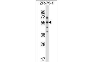 Western blot analysis in ZR-75-1 cell line lysates (35ug/lane). (SGK3 antibody  (C-Term))