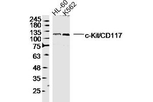 Lane 1: HL-60 lysates Lane 2: K562 lysates probed with c-Kit/CD117 Polyclonal Antibody, Unconjugated  at 1:300 dilution and 4˚C overnight incubation. (KIT antibody  (AA 451-550))
