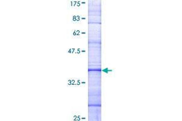 TAS2R14 Protein (AA 151-260) (GST tag)