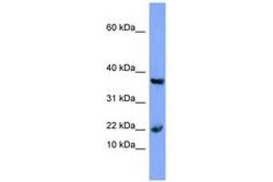 Image no. 1 for anti-Myoglobin (MB) (N-Term) antibody (ABIN6741647) (Myoglobin antibody  (N-Term))