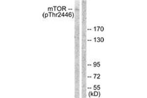 Western blot analysis of extracts from NIH-3T3 cells treated with Insulin 0. (MTOR antibody  (pThr2446))
