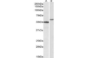 ABIN4902571 (0. (CD47 antibody)