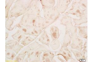 Formalin-fixed and paraffin embedded rat skeletal muscle labeled with Rabbit Anti MYPN Polyclonal Antibody, Unconjugated (ABIN1714212) at 1:200 followed by conjugation to the secondary antibody and DAB staining (Myopalladin antibody  (AA 901-1000))