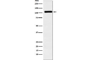 Western blot analysis of MIB1 / DIP1 expression in Caco2 cell lysate.