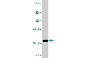 Western Blot detection against Immunogen (35. (CPT1A antibody  (AA 461-550))