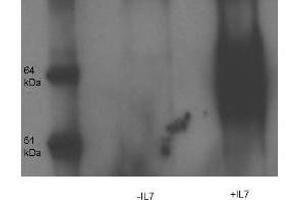Western Blot and immunoprecipitation of Rabbit anti- IL-7-Receptor-alpha-chain-pY449 antibody. (IL7R antibody  (pTyr449))