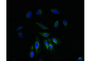 Immunofluorescent analysis of Hela cells using ABIN7160886 at dilution of 1:100 and Alexa Fluor 488-congugated AffiniPure Goat Anti-Rabbit IgG(H+L) (NDUFA1 antibody  (AA 1-70))