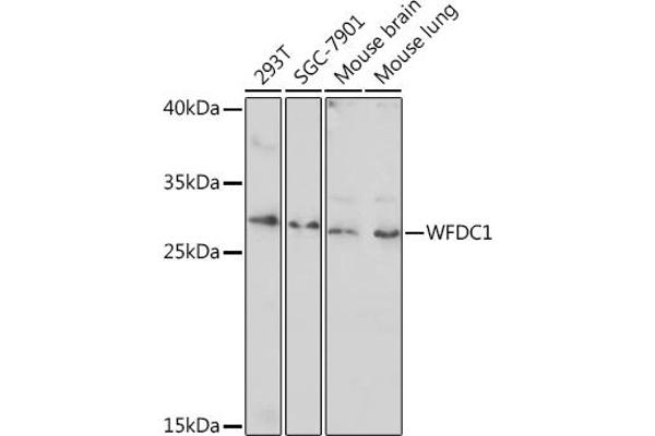 WFDC1 抗体  (AA 111-220)