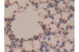 Detection of SOSTDC1 in Mouse Lung Tissue using Polyclonal Antibody to Sclerostin Domain Containing Protein 1 (SOSTDC1) (SOSTDC1 antibody  (AA 24-206))