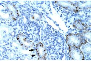 Human kidney (TCFL5 antibody  (Middle Region))