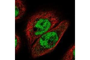 Immunofluorescent staining of human cell line A-431 with IGFALS polyclonal antibody  at 1-4 ug/mL dilution shows positivity in nucleus but not nucleoli. (IGFALS antibody)