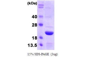 SDS-PAGE (SDS) image for Ferritin, Light Polypeptide (FTL) (AA 1-175) protein (ABIN667723) (FTL Protein (AA 1-175))