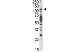 Western Blotting (WB) image for anti-Phosphoinositide-3-Kinase, Catalytic, delta Polypeptide (PIK3CD) antibody (ABIN3003631) (PIK3CD antibody)