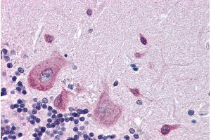 ABIN185398 (3. (DPP10 antibody  (Internal Region))