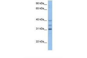 Image no. 1 for anti-Homeobox D1 (HOXD1) (AA 254-303) antibody (ABIN6737882) (HOXD1 antibody  (AA 254-303))