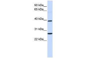 WB Suggested Anti-WNT16 Antibody Titration:  0. (WNT16 antibody  (Middle Region))