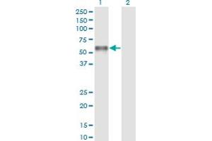 Western Blot analysis of PROC expression in transfected 293T cell line by PROC monoclonal antibody (M01), clone 3A10. (PROC antibody  (AA 32-131))