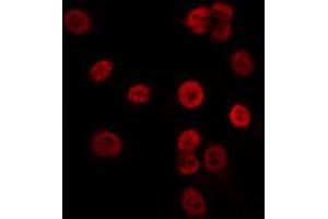 ABIN6274072 staining K562 by IF/ICC. (CDKN1C antibody  (pThr310))