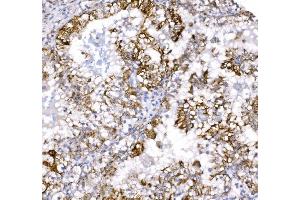 IHC analysis of COX6B1 using anti-COX6B1 antibody (ABIN7603206). (COX6B1 antibody  (N-Term))