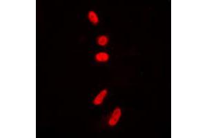 Immunofluorescent analysis of p53 (AcK381) staining in HeLa cells. (p53 antibody  (acLys381, C-Term))
