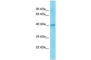 Host:  Rabbit  Target Name:  Tmem25  Sample Type:  Mouse Pancreas lysates  Antibody Dilution:  1. (TMEM25 antibody  (C-Term))