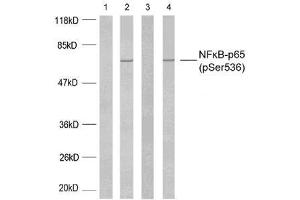 Western blot analysis using NF-κB p65 (phospho-Ser536) antibody (E011014). (NF-kB p65 antibody  (pSer536))