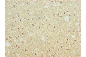 Immunohistochemistry of paraffin-embedded human brain tissue using ABIN7151639 at dilution of 1:100 (SH3G2 antibody  (AA 1-270))