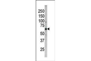 Image no. 1 for anti-Cell Division Cycle 25 Homolog B (S. Pombe) (CDC25B) (pSer187) antibody (ABIN358100) (CDC25B antibody  (pSer187))
