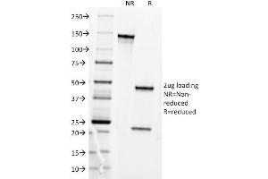 SDS-PAGE (SDS) image for anti-Transferrin Receptor (p90, CD71) (TFRC) antibody (ABIN6940694)