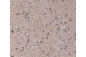 Used in DAB staining on fromalin fixed paraffin- embedded brain tissue (PSMG2 antibody  (AA 1-264))