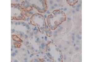 Figure. (Trichohyalin antibody  (AA 1851-1943))