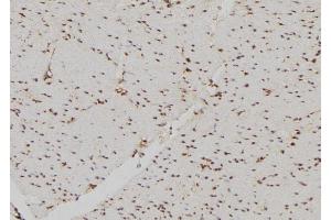 ABIN6269226 at 1/100 staining Human gastric tissue by IHC-P. (DDIT3 antibody  (N-Term))
