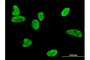 Immunofluorescence of monoclonal antibody to BAX on HeLa cell. (BAX antibody  (AA 1-192))