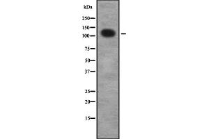 Western blot analysis UBE3B using Jurkat whole cell lysates