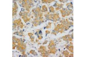 Image no. 1 for anti-Fibroblast Growth Factor 4 (FGF4) (C-Term) antibody (ABIN1492933) (FGF4 antibody  (C-Term))