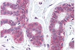 Anti-SLC39A6 antibody  ABIN960811 IHC staining of human breast. (SLC39A6 antibody  (Internal Region))
