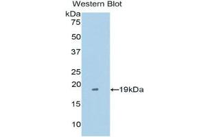 Western Blotting (WB) image for anti-Tumor Necrosis Factor Receptor Superfamily, Member 21 (TNFRSF21) (AA 420-568) antibody (ABIN1176213) (TNFRSF21 antibody  (AA 420-568))
