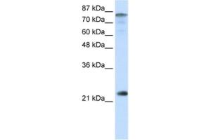 Western Blotting (WB) image for anti-Nuclear Transcription Factor Y, beta (NFYB) antibody (ABIN2461778) (NFYB antibody)