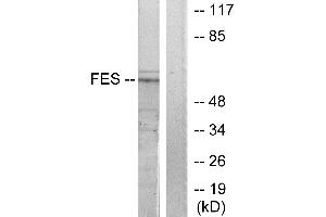 Western blot analysis of extracts from HUVEC cells, treated with serum (20%, 30mins), using FES antibody. (FES antibody  (Internal Region))