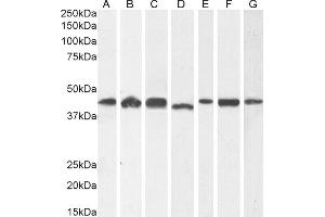 (ABIN185219) (1 μg/mL) staining of A431 (A) and HeLa (B), (2 μg/mL) HEK293 (C) and (0. (ACTR1A antibody  (C-Term))