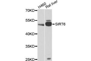 Western blot analysis of extracts of various cell lines, using CALU antibody. (CALU antibody)