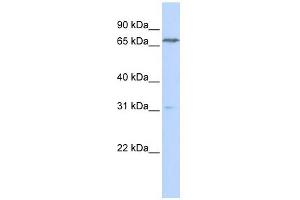 PCCA antibody used at 1 ug/ml to detect target protein. (PCCA antibody  (N-Term))