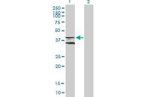 Western Blot analysis of ADRB3 expression in transfected 293T cell line by ADRB3 MaxPab polyclonal antibody. (ADRB3 antibody  (AA 1-408))
