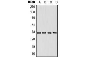 Western blot analysis of hnRNP E1 expression in HeLa (A), K562 (B), SP2/0 (C), PC12 (D) whole cell lysates. (PCBP1 antibody  (N-Term))