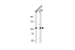 Western blot analysis of lysates from SH-SY5Y, Y79 cell line (from left to right), using CDH8 Antibody (N-term) (ABIN388149 and ABIN2846895).