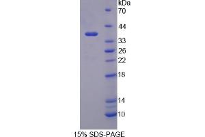 Image no. 1 for Synapsin I (SYN1) (AA 113-420) protein (His tag) (ABIN6237817) (SYN1 Protein (AA 113-420) (His tag))