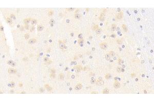 Detection of NOS1 in Mouse Cerebrum Tissue using Polyclonal Antibody to Nitric Oxide Synthase 1, Neuronal (NOS1) (NOS1 antibody  (AA 691-826))