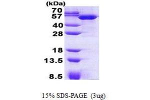 Image no. 1 for Tubulin Folding Cofactor E-Like (TBCEL) protein (His tag) (ABIN1098529)