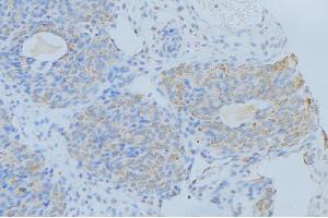 ABIN6276366 at 1/100 staining Human uterus tissue by IHC-P. (IL-2 antibody  (Internal Region))